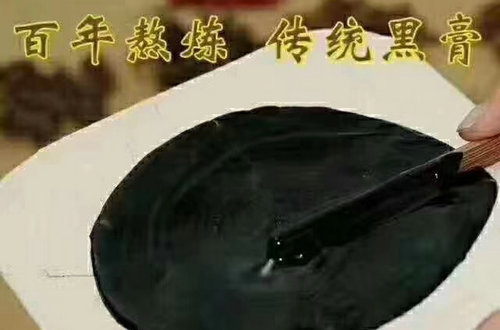 膝盖一到阴雨天就疼痛是什么原因